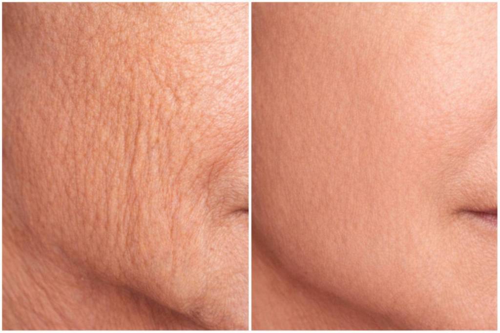 Environ Skincare, SkinFuture, Colágeno