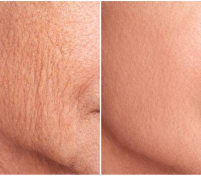 Environ Skincare, SkinFuture, Colágeno