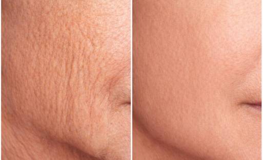 Environ Skincare, SkinFuture, Colágeno